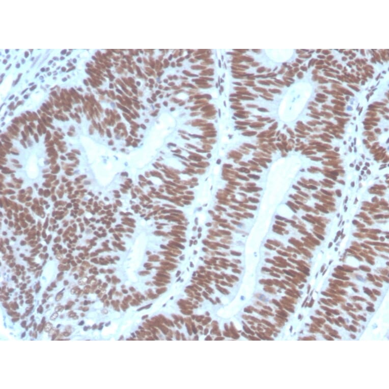 Immunohistochemistry - Anti-PAX2 Antibody [PAX2/1104] (A249559) - Antibodies.com