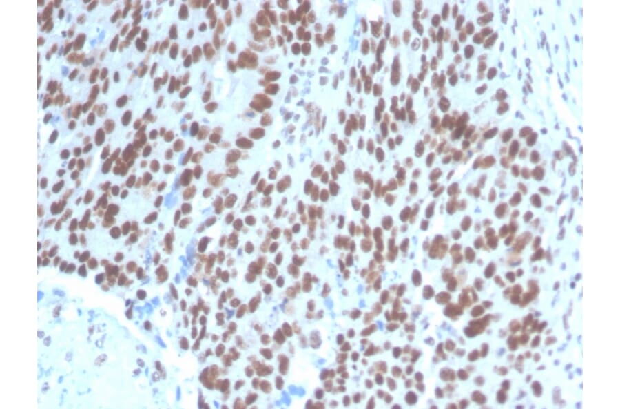 Immunohistochemistry - Anti-PAX2 Antibody [PAX2/1104] (A249559) - Antibodies.com