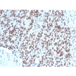 Immunohistochemistry - Anti-PAX2 Antibody [PAX2/1104] (A249559) - Antibodies.com