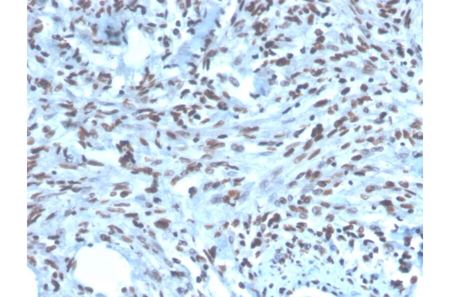 Immunohistochemistry - Anti-PAX2 Antibody [PAX2/1104] (A249559) - Antibodies.com