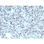 Immunohistochemistry - Anti-PAX2 Antibody [PAX2/1104] (A249559) - Antibodies.com