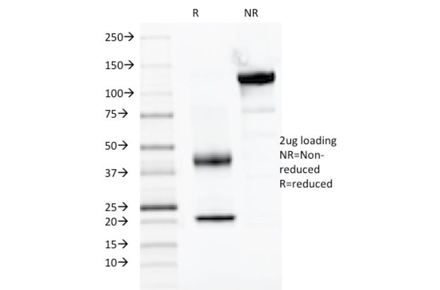 SDS-PAGE - Anti-PAX2 Antibody [PAX2/1104] (A249559) - Antibodies.com
