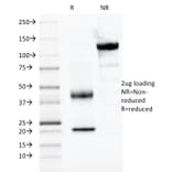 SDS-PAGE - Anti-PAX2 Antibody [PAX2/1104] (A249559) - Antibodies.com