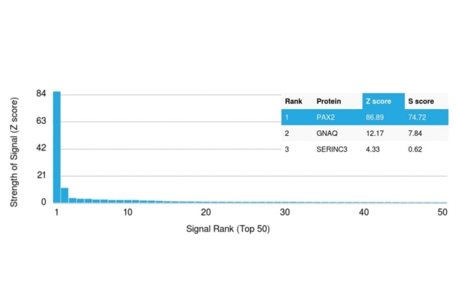 Protein Array - Anti-PAX2 Antibody [PAX2/1104] (A249558) - Antibodies.com