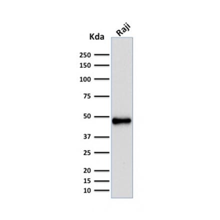 Western Blot - Anti-PAX5 Antibody [rPAX5/2060] (A249561) - Antibodies.com