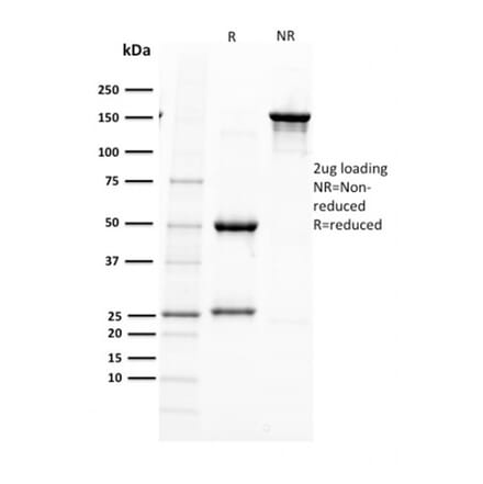 SDS-PAGE - Anti-PAX5 Antibody [PAX5/2595] (A249561) - Antibodies.com