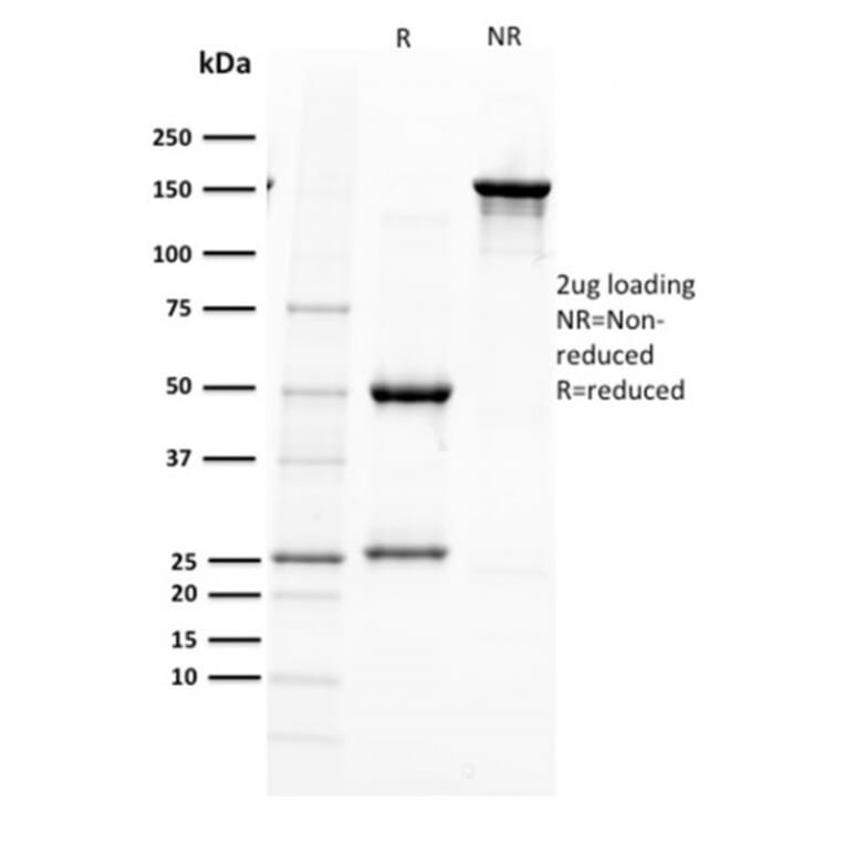 SDS-PAGE - Anti-PAX5 Antibody [PAX5/2595] (A249561) - Antibodies.com