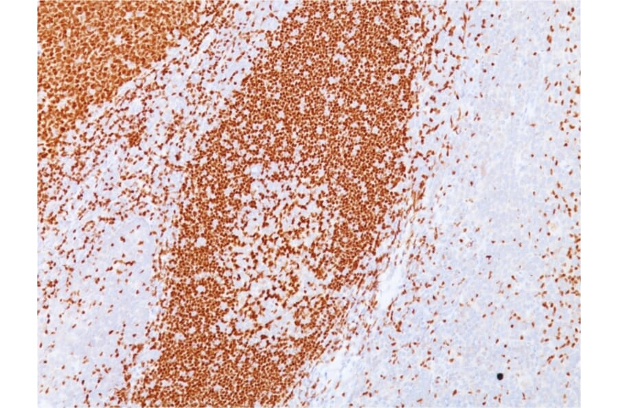 Immunohistochemistry - Anti-PAX5 Antibody [PAX5/3735] (A249563) - Antibodies.com
