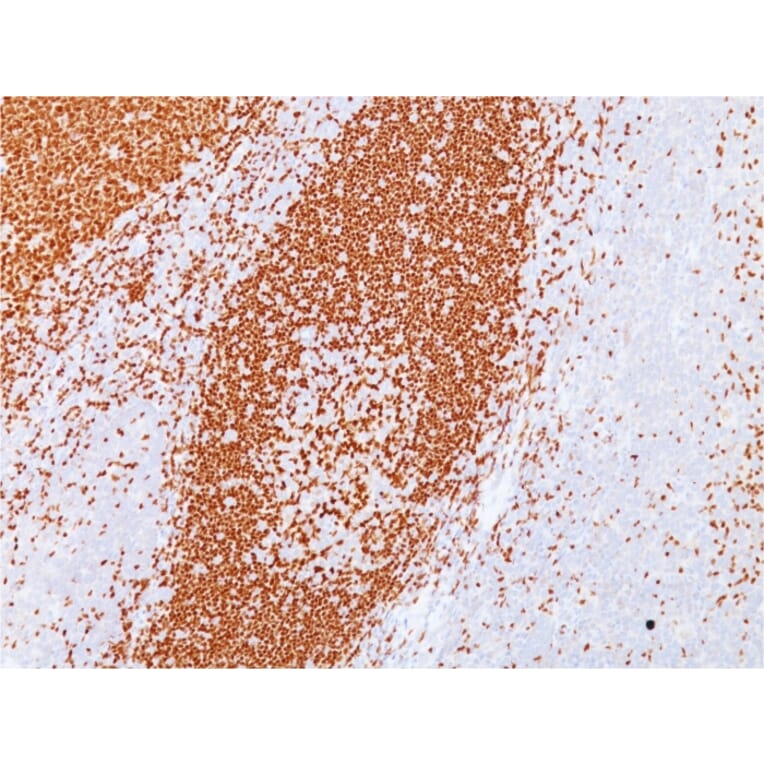 Immunohistochemistry - Anti-PAX5 Antibody [PAX5/3735] (A249563) - Antibodies.com