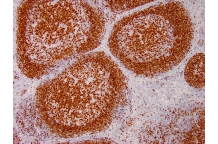 Immunohistochemistry - Anti-PAX5 Antibody [PAX5/3735] (A249563) - Antibodies.com