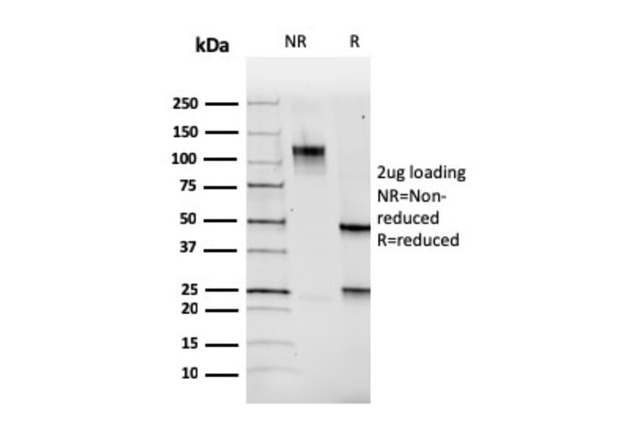 SDS-PAGE - Anti-PAX5 Antibody [PAX5/3735] (A249563) - Antibodies.com