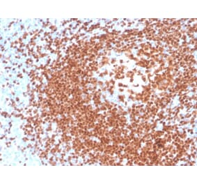 Immunohistochemistry - Anti-PAX5 Antibody [rPAX5/4228] (A249564) - Antibodies.com
