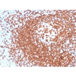 Immunohistochemistry - Anti-PAX5 Antibody [rPAX5/4228] (A249564) - Antibodies.com