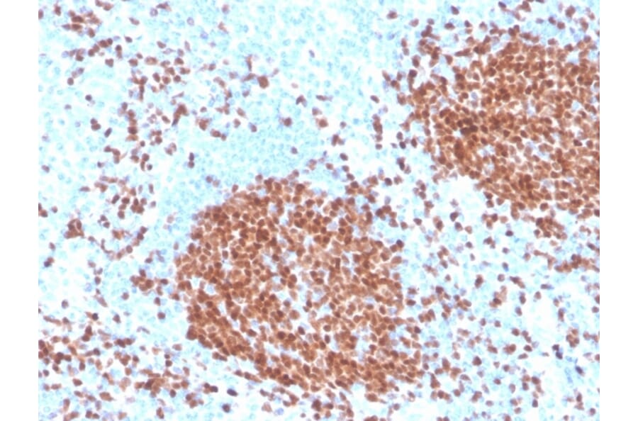 Immunohistochemistry - Anti-PAX5 Antibody [rPAX5/4228] (A249563) - Antibodies.com