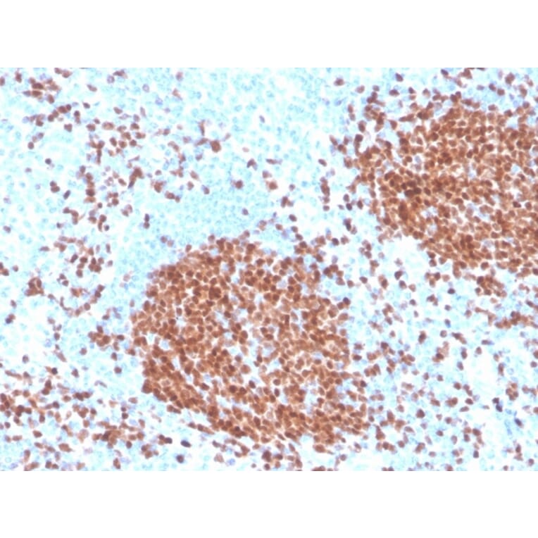 Immunohistochemistry - Anti-PAX5 Antibody [rPAX5/4228] (A249563) - Antibodies.com