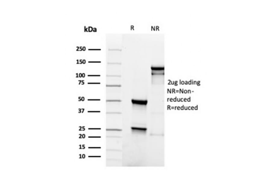 SDS-PAGE - Anti-PAX5 Antibody [rPAX5/4228] (A249564) - Antibodies.com