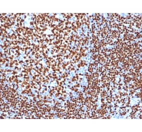 Immunohistochemistry - Anti-PAX5 Antibody [PAX5/3977R] (A249565) - Antibodies.com