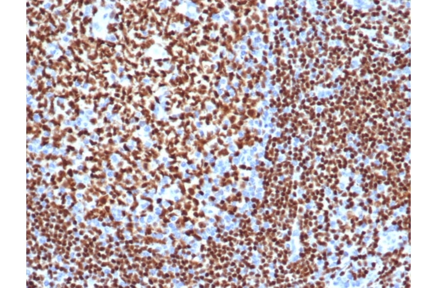 Immunohistochemistry - Anti-PAX5 Antibody [PAX5/3977R] (A249565) - Antibodies.com