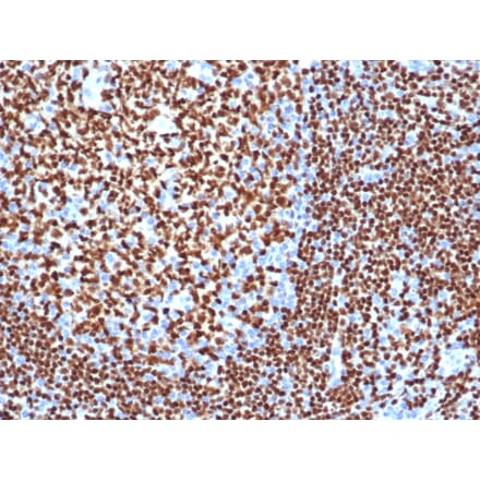 Immunohistochemistry - Anti-PAX5 Antibody [PAX5/3977R] (A249565) - Antibodies.com
