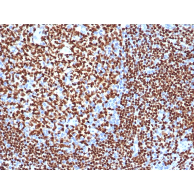 Immunohistochemistry - Anti-PAX5 Antibody [PAX5/3977R] (A249565) - Antibodies.com