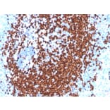 Immunohistochemistry - Anti-PAX5 Antibody [PAX5/3977R] (A249564) - Antibodies.com