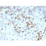 Immunohistochemistry - Anti-PAX6 Antibody [SPM612] (A249567) - Antibodies.com