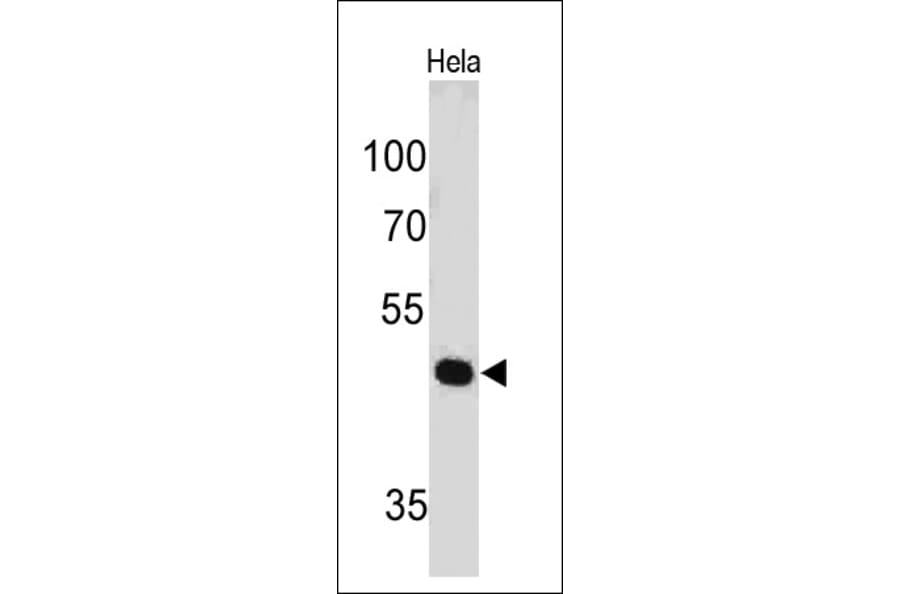 Western Blot - Anti-PAX7 Antibody [PAX7/497] (A249569) - Antibodies.com
