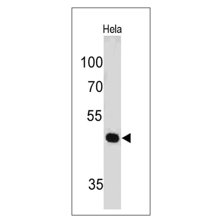 Western Blot - Anti-PAX7 Antibody [PAX7/497] (A249569) - Antibodies.com