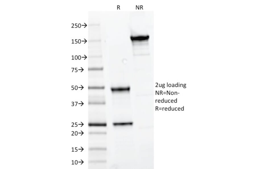 SDS-PAGE - Anti-PAX7 Antibody [PAX7/497] (A249568) - Antibodies.com