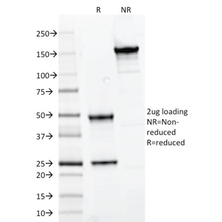 SDS-PAGE - Anti-PAX7 Antibody [PAX7/497] (A249568) - Antibodies.com