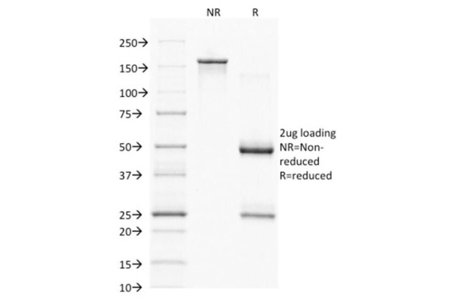 SDS-PAGE - Anti-PAX7 Antibody [PAX7/1187] (A249570) - Antibodies.com