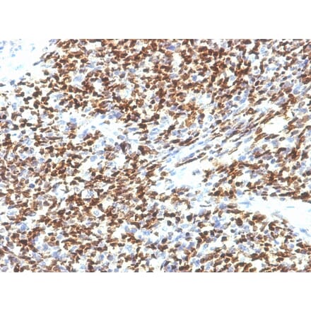 Immunohistochemistry - Anti-PAX7 Antibody [SPM613] (A249570) - Antibodies.com