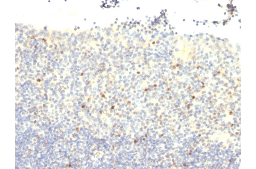 Immunohistochemistry - Anti-FOXP3 Antibody [FXP3/197] (A249573) - Antibodies.com