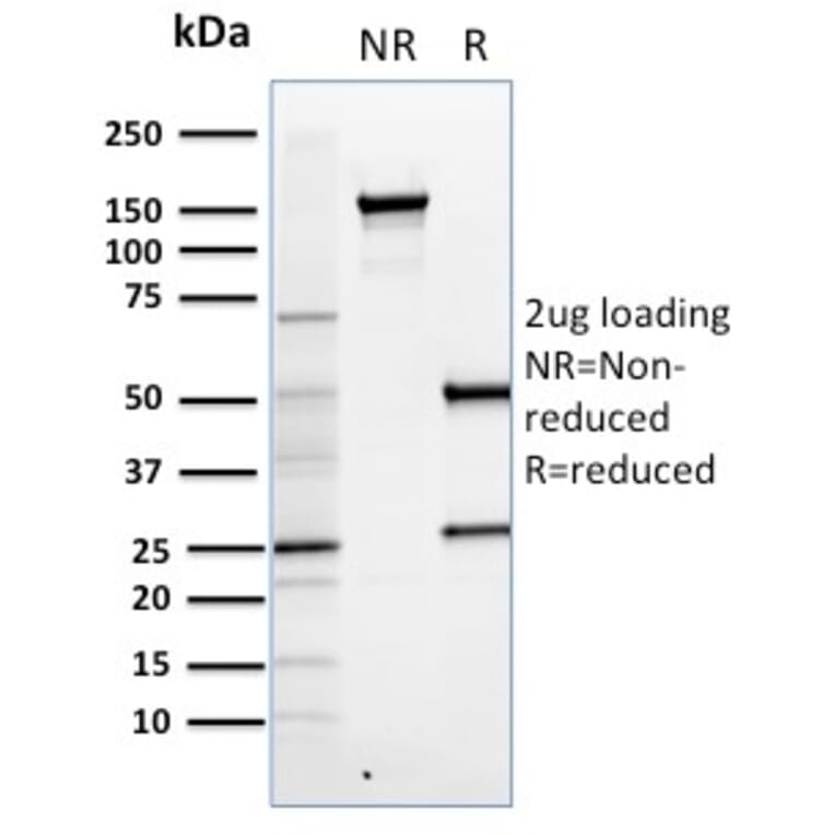 SDS-PAGE - Anti-FOXP3 Antibody [FXP3/197] (A249573) - Antibodies.com