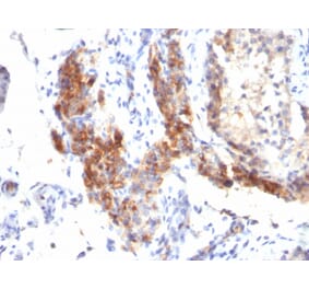 Immunohistochemistry - Anti-FOXP3 Antibody [SPM579] (A249573) - Antibodies.com