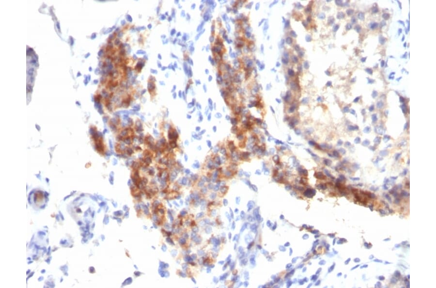 Immunohistochemistry - Anti-FOXP3 Antibody [SPM579] (A249573) - Antibodies.com