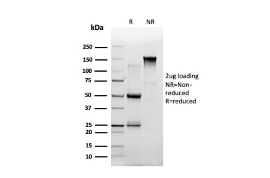 SDS-PAGE - Anti-ThPok Antibody [PCRP-ZBTB7B-1B6] (A249575) - Antibodies.com