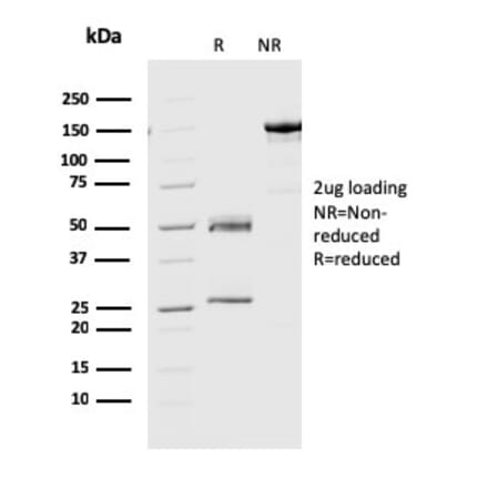 SDS-PAGE - Anti-Geminin Antibody [CPTC-GMNN-1] (A249577) - Antibodies.com
