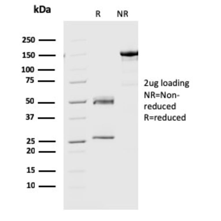 SDS-PAGE - Anti-Geminin Antibody [CPTC-GMNN-1] (A249577) - Antibodies.com