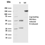 SDS-PAGE - Anti-Geminin Antibody [CPTC-GMNN-1] (A249577) - Antibodies.com