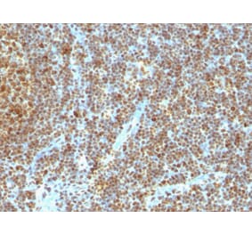 Immunohistochemistry - Anti-PCNA Antibody [SPM350] (A249578) - Antibodies.com