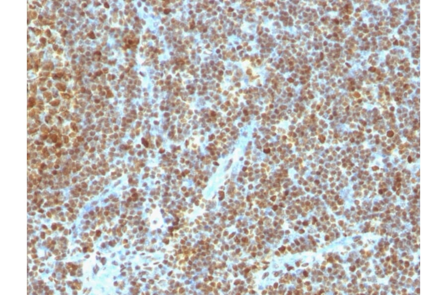 Immunohistochemistry - Anti-PCNA Antibody [SPM350] (A249578) - Antibodies.com