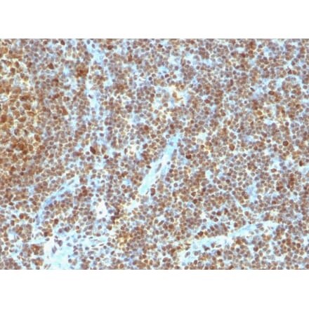 Immunohistochemistry - Anti-PCNA Antibody [SPM350] (A249578) - Antibodies.com