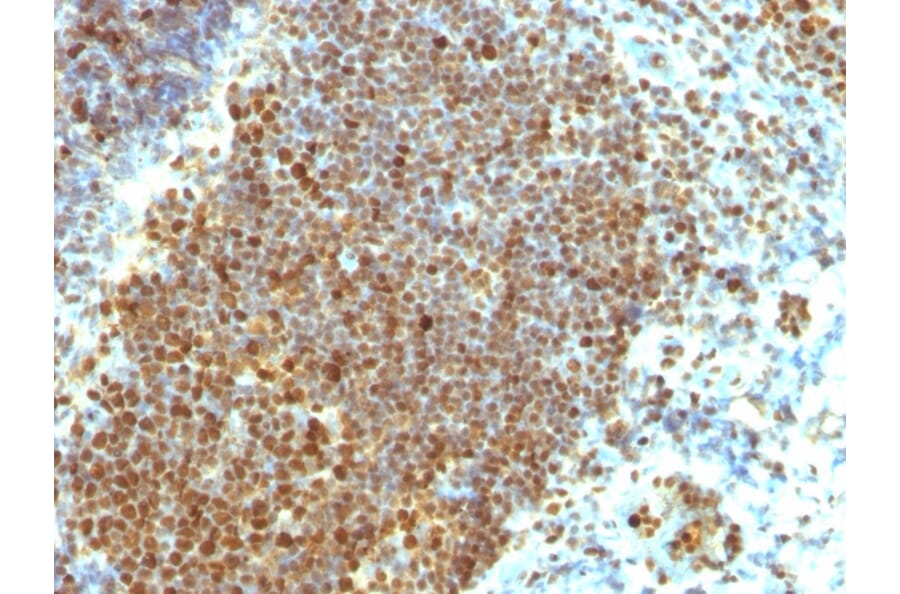 Immunohistochemistry - Anti-PCNA Antibody [PCNA/694] (A249580) - Antibodies.com