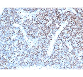 Immunohistochemistry - Anti-LEF1 Antibody [LEF1/341R] (A249581) - Antibodies.com