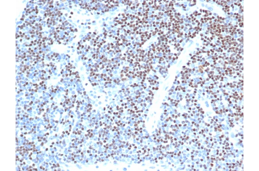 Immunohistochemistry - Anti-LEF1 Antibody [LEF1/341R] (A249581) - Antibodies.com