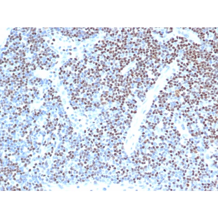 Immunohistochemistry - Anti-LEF1 Antibody [LEF1/341R] (A249581) - Antibodies.com