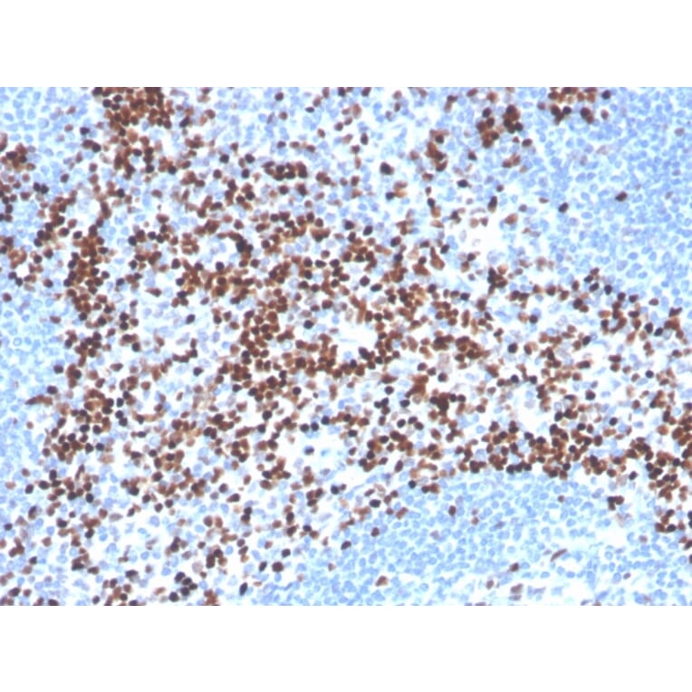 Immunohistochemistry - Anti-LEF1 Antibody [LEF1/341R] (A249582) - Antibodies.com