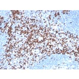 Immunohistochemistry - Anti-LEF1 Antibody [LEF1/341R] (A249582) - Antibodies.com