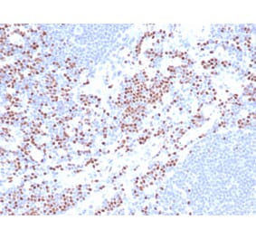 Immunohistochemistry - Anti-LEF1 Antibody [LEF1/422R] (A249582) - Antibodies.com